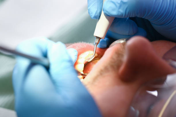 Best Emergency Denture Repair in Chicago Ridge, IL
