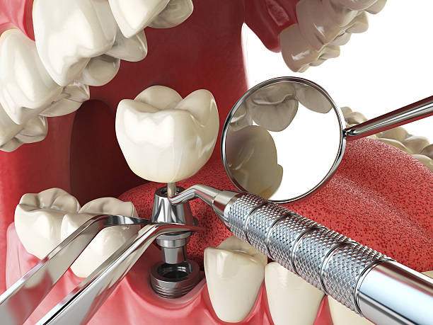 Best Urgent Care for Lost Fillings or Crowns in Chicago Ridge, IL